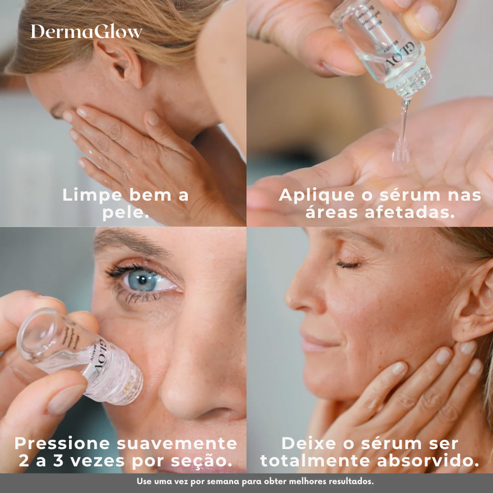 DermaGlow™ – Sistema Avançado de Microinfusão Facial com Ácido Hialurónico