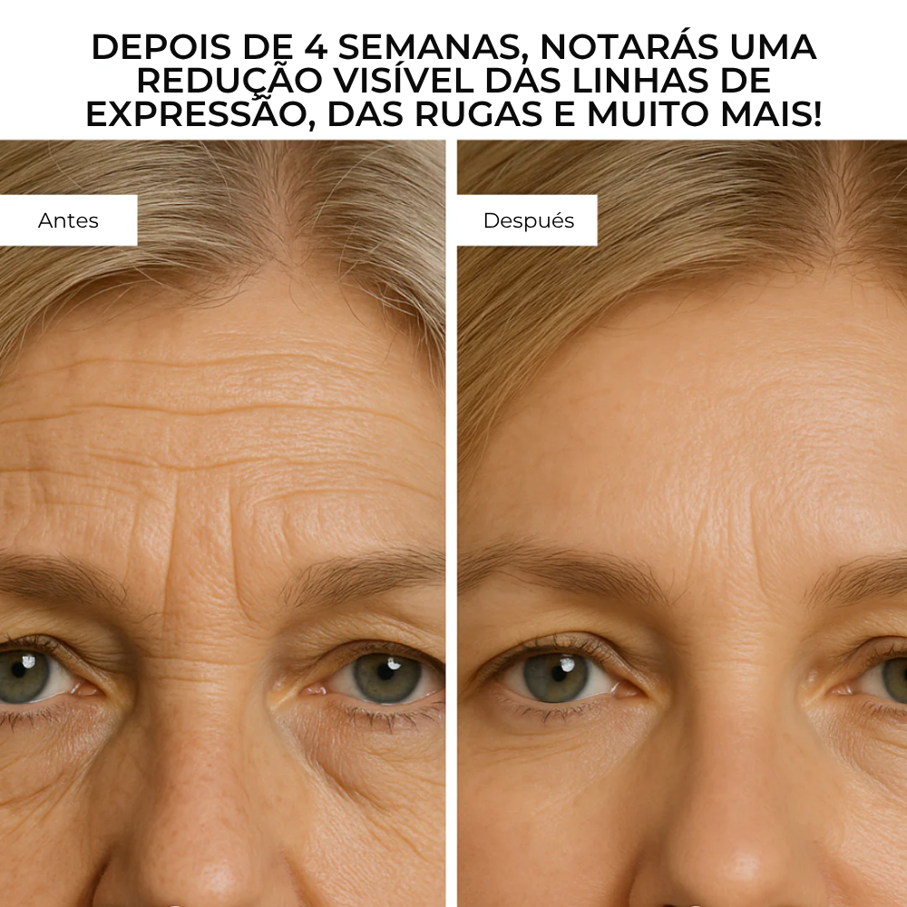 DermaGlow™ – Sistema Avançado de Microinfusão Facial com Ácido Hialurónico