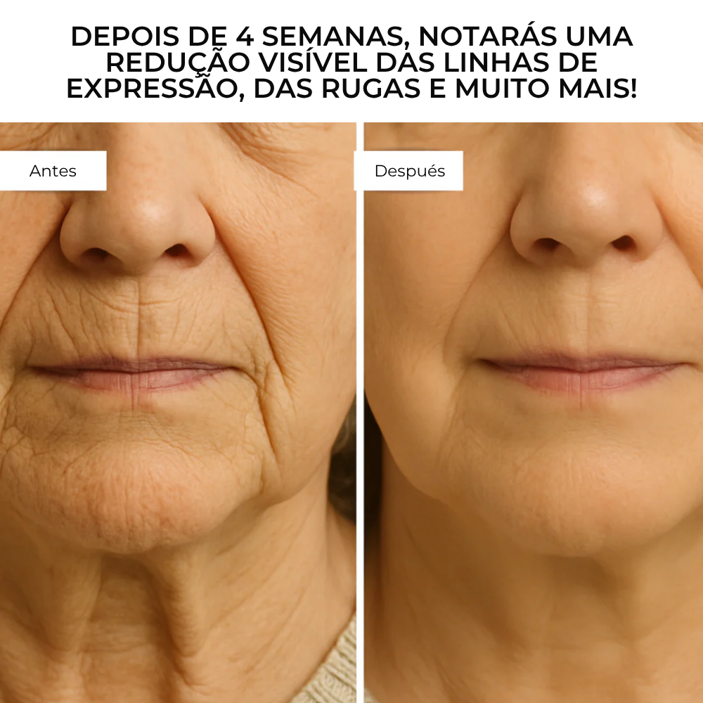 DermaGlow™ – Sistema Avançado de Microinfusão Facial com Ácido Hialurónico